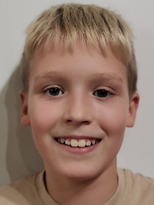 Timon Kuzma