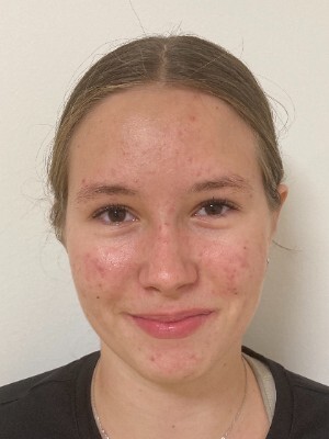 Petra Novotná
