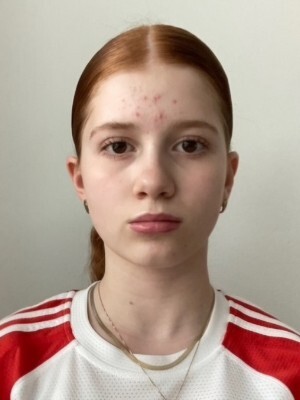 Anna Belanová