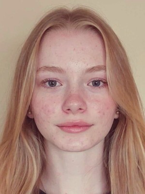 Natália Brošová