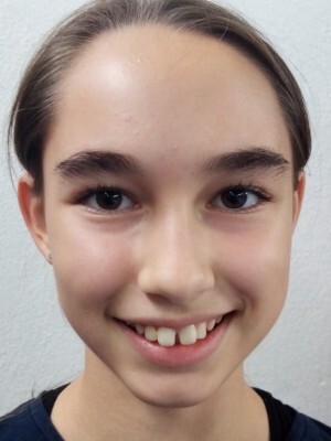 Chiara Ballová