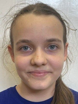 Ester Švedová